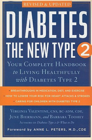 Kniha Diabetes: the New Type 2 Barbara Toohey