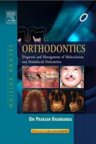 Buch Orthodontics: Diagnosis of & Management of Malocclusion & Dentofacial Deformities Om Prakash Kharbanda