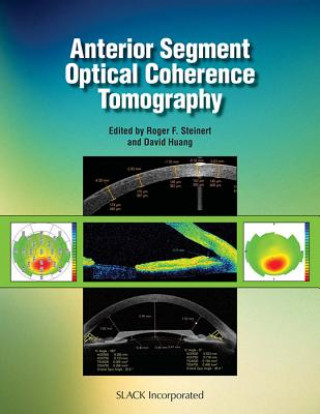 Książka Anterior Segment Optical Coherence Tomography David Huang