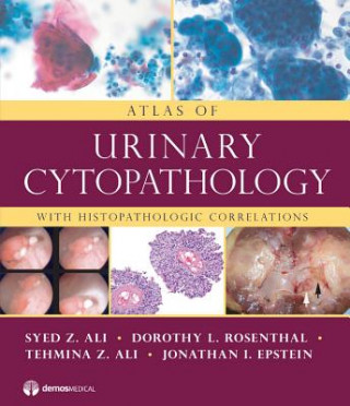 Książka Atlas of Urinary Cytopathology Jonathan I. Epstein