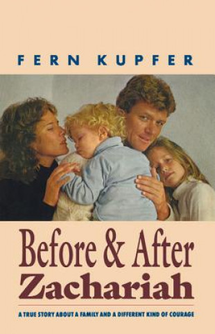 Livre Before and After Zachariah Fern Kupfer