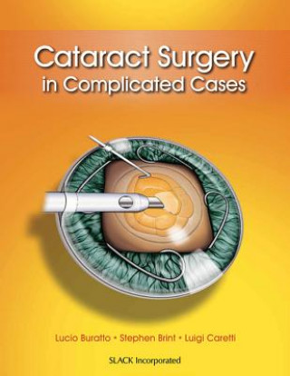 Kniha Cataract Surgery in Complicated Cases Luigi Caretti