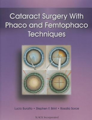 Książka Cataract Surgery with Phaco and Femtophaco Techniques Rosalia Sorce