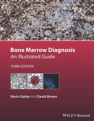 Libro Bone Marrow Diagnosis - An Illustrated Guide 3e Kevin Gatter