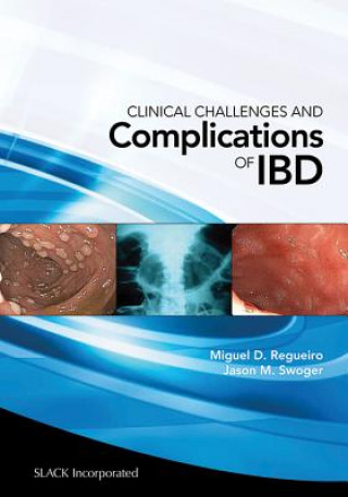 Kniha Clinical Challenges and Complications of IBD Roger F. Wells