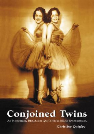 Knjiga Conjoined Twins Christine Quigley