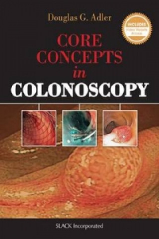 Książka Core Concepts in Colonoscopy Adler