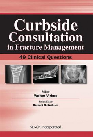 Knjiga Curbside Consultation in Fracture Management Walter Virkus