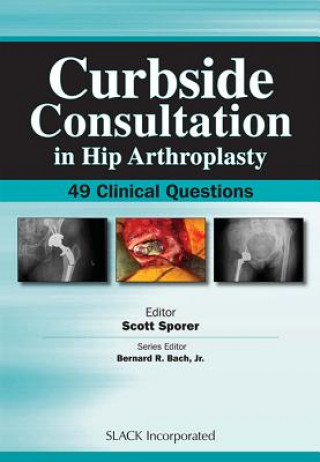 Książka Curbside Consultation in Hip Arthroplasty Scott M. Sporer