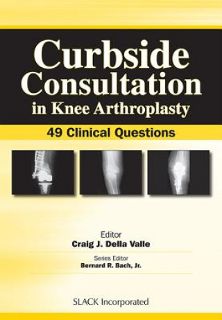 Książka Curbside Consultation in Knee Arthroplasty Craig J. Della Valle