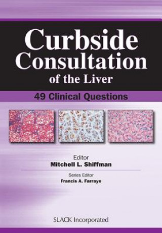 Книга Curbside Consultation of the Liver Mitchell L. Shiffman