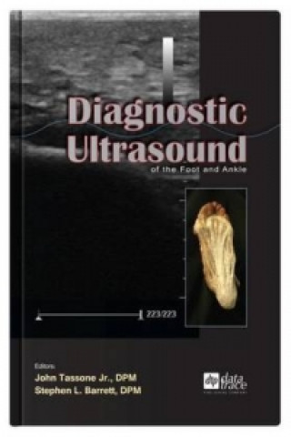 Książka Diagnostic Ultrasound of the Foot and Ankle 