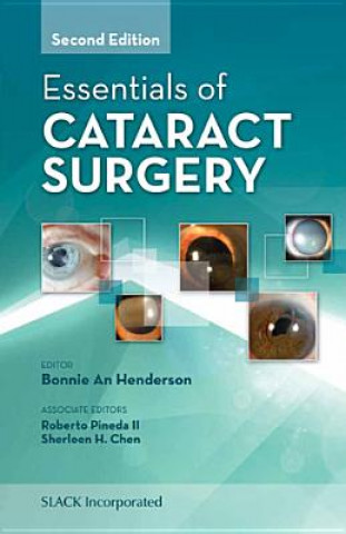 Carte Essentials of Cataract Surgery Henderson