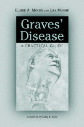 Книга Graves' Disease Lisa Moore