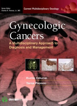 Carte Gynecologic Cancers Tanja Pejovic