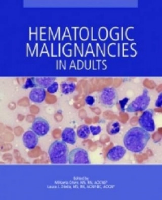 Książka Hematologic Malignancies in Adults 