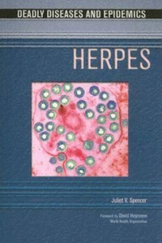 Boek Herpes Juliet V. Spencer