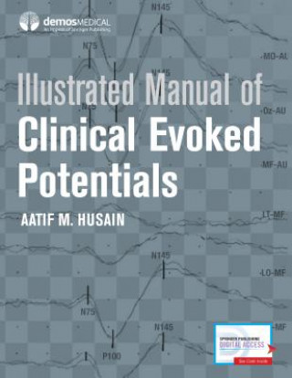 Kniha Illustrated Manual of Clinical Evoked Potentials Aatif M. Husain