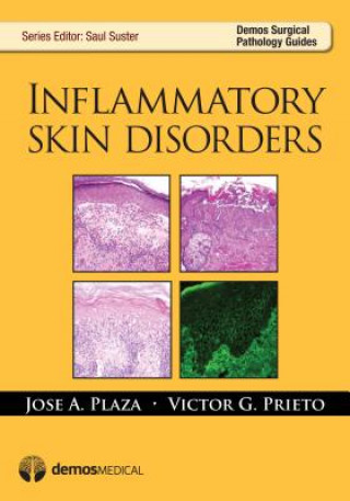 Kniha Inflammatory Skin Disorders Victor G. Prieto