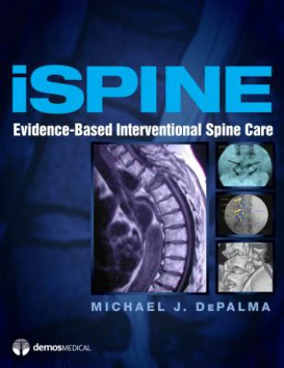 Könyv ISpine Michael J. DePalma