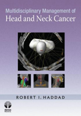 Książka Multidisciplinary Management of Head and Neck Cancer Robert I. Haddad