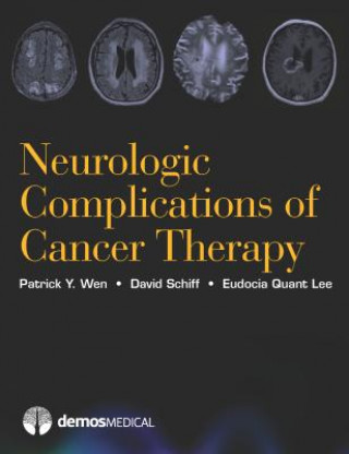 Kniha Neurologic Complications of Cancer Therapy Patrick Y. Wen