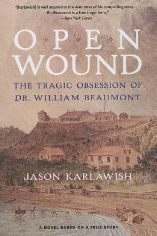 Book Open Wound Jason Karlawish