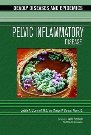 Buch Pelvic Inflammatory Disease Judith O'Donnell