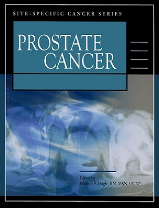 Książka Prostate Cancer William P. Hogle