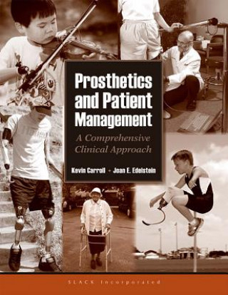 Kniha Prosthetics and Patient Management Joan E. Edelstein
