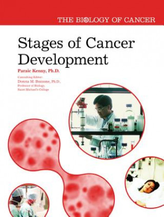 Kniha Stages of Cancer Development Paraic Kenny