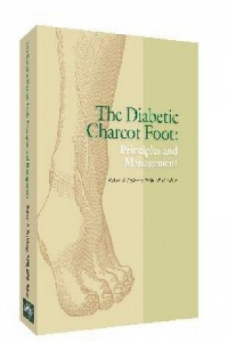 Carte Diabetic Charcot Foot 