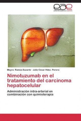 Kniha Nimotuzumab en el tratamiento del carcinoma hepatocelular Mayra Ramos-Suzarte