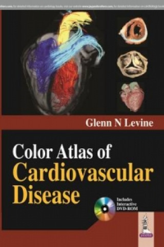 Knjiga Color Atlas of Cardiovascular Disease Glenn N. Levine