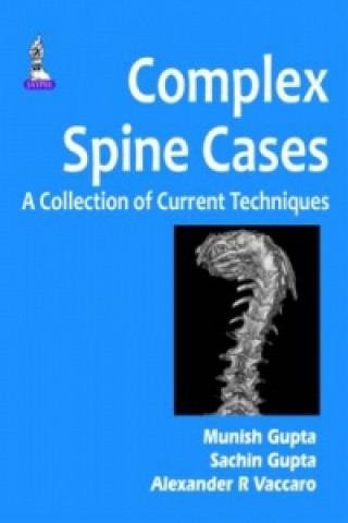 Kniha Complex Spine Cases: A Collection of Current Techniques Munish C. Gupta