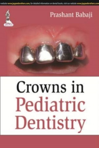 Książka Crowns in Pediatric Dentistry Prashant Babaji