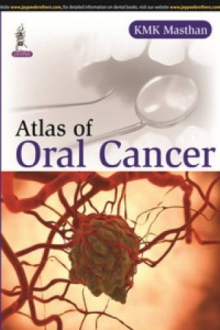 Kniha Color Atlas of Oral Cancer KMK Masthan