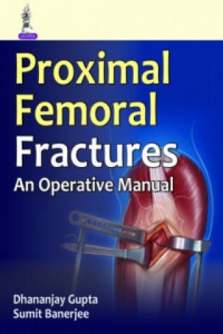 Book Operative Manual of Proximal Femoral Fractures Dhananjay Gupta