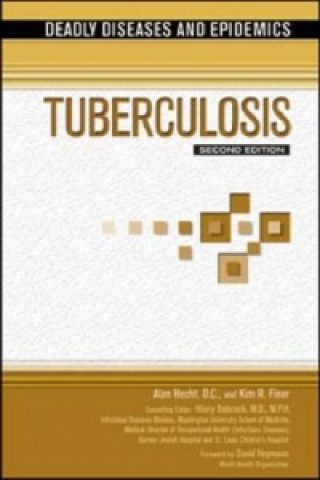 Carte Tuberculosis Alan Hecht