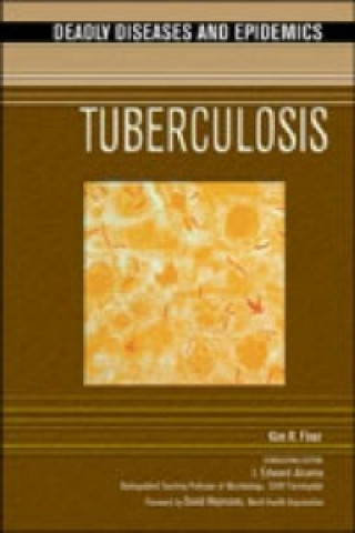 Book Tuberculosis Kim R. Finer