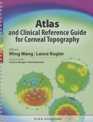 Carte Atlas and Clinical Reference Guide for Corneal Topography 