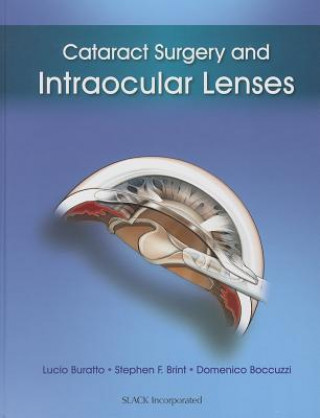 Kniha Cataract Surgery and Intraocular Lenses Domenico Boccuzzi