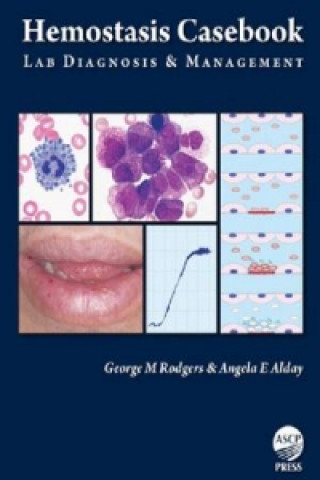 Buch Hemostasis Casebook Angela E. Alday