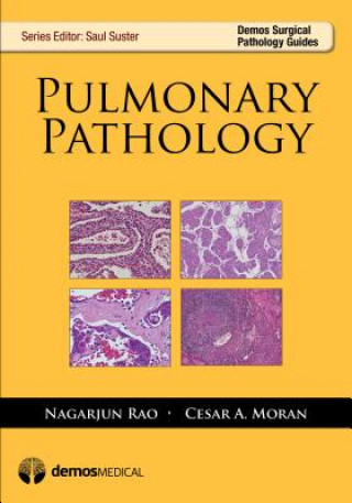 Kniha Pulmonary Pathology Moran