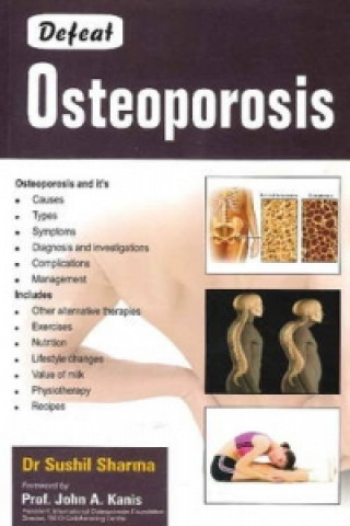 Könyv Defeat Osteoporosis Sushil Sharma