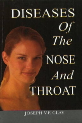 Carte Diseases of the Nose & Throat Joseph V. F. Clay