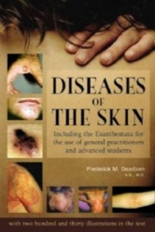 Carte Diseases of the Skin Frederick M. Dearborn