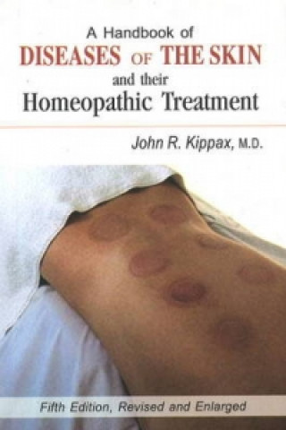 Knjiga Handbook of Diseases of the Skin John R. Kippax