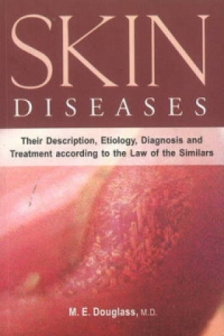 Książka Skin Diseases M. E. Douglas