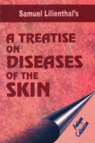 Książka Treatise on Diseases of the Skin Lilienthal